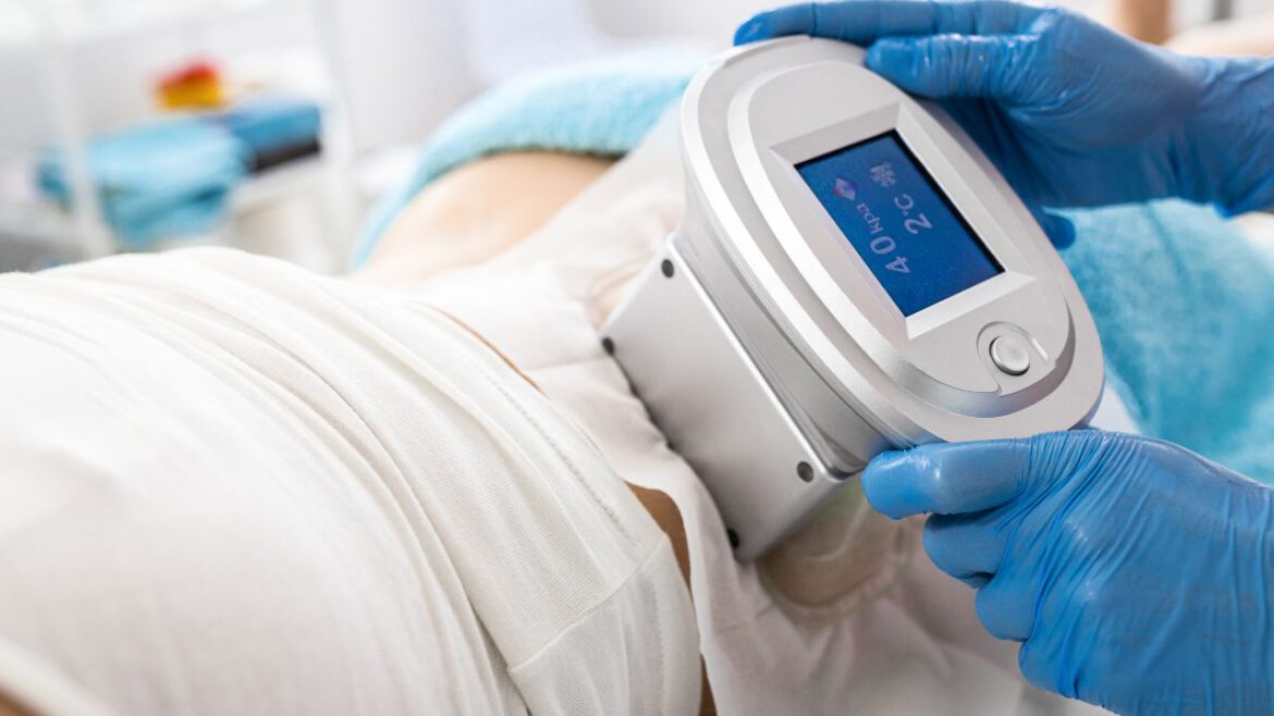 Kriolipoliza LS-PRO: Nowoczesne Rozwiązanie w Walce z Lokalnymi Zbędymi Kilogramami