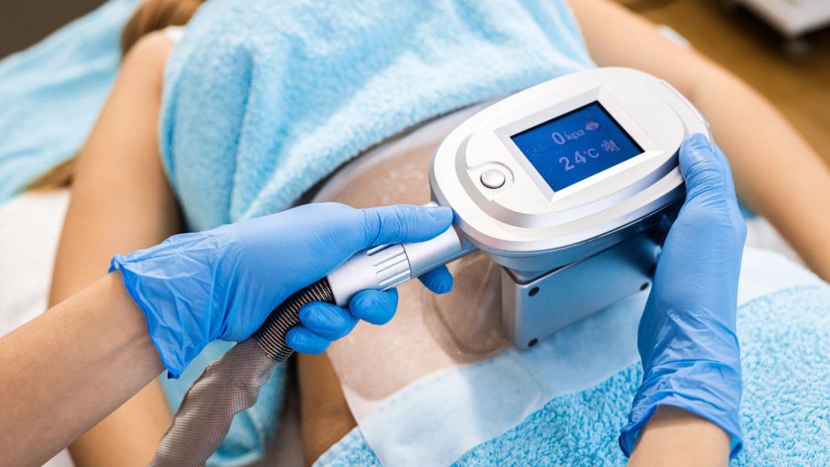 Kriopoliza: Innowacyjne chłodzenie tkanki tłuszczowej jako sekret smukłej sylwetki w Siluetta