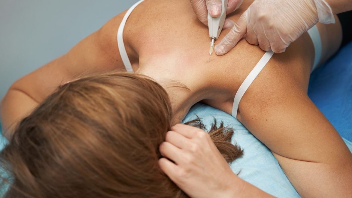 Najnowsze trendy w pielęgnacji ciała: Karboksyterapia - czy warto wypróbować?