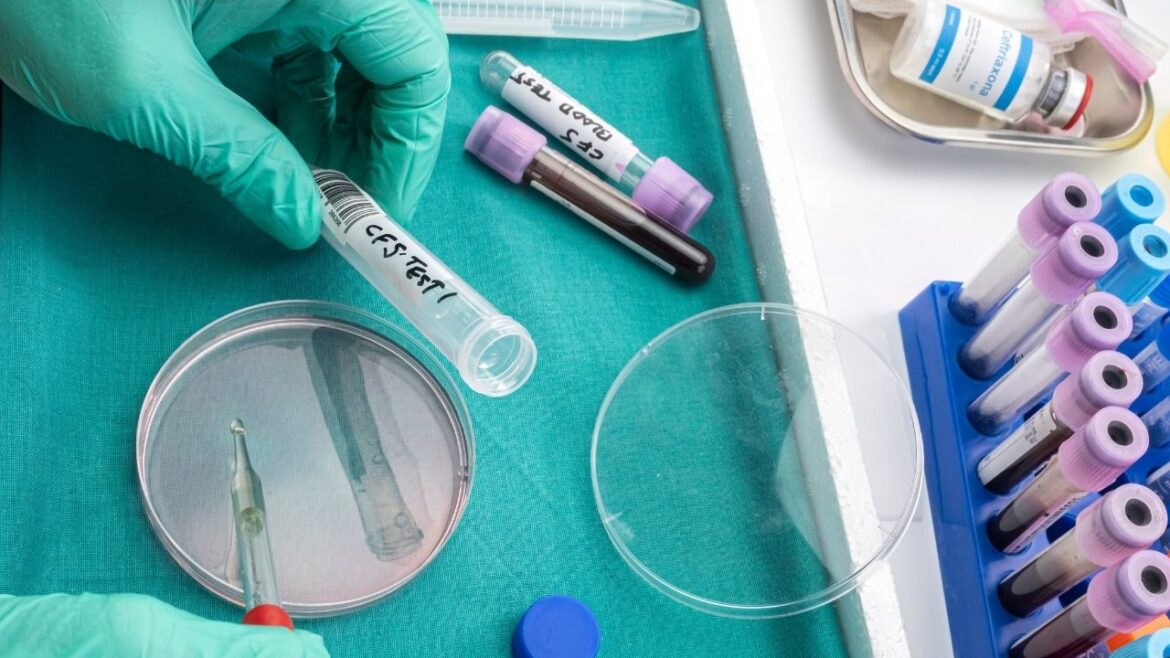 Najnowsze odkrycia w badaniach autoimmunologicznych: co nowego w leczeniu chorób autoimmunologicznych?