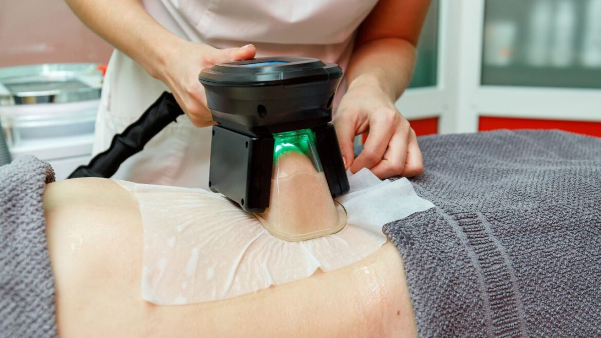 Kriolipoliza – Rewolucyjna metoda na modelowanie sylwetki