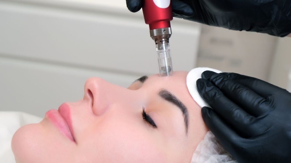 Mezoterapia igłowa Xela Rederm: Rewolucyjne metody poprawy stanu skóry