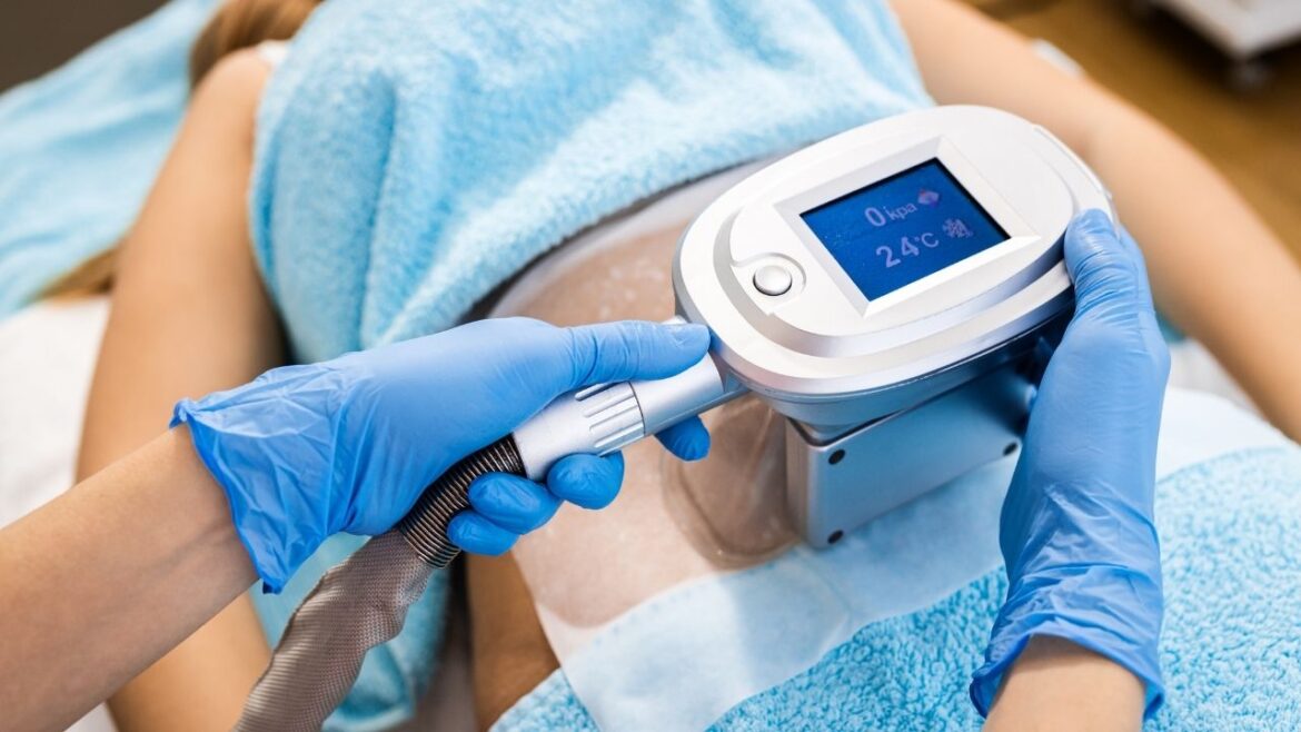 Kriolipoliza krok po kroku — jak pozbyć się tkanki tłuszczowej bez skalpela